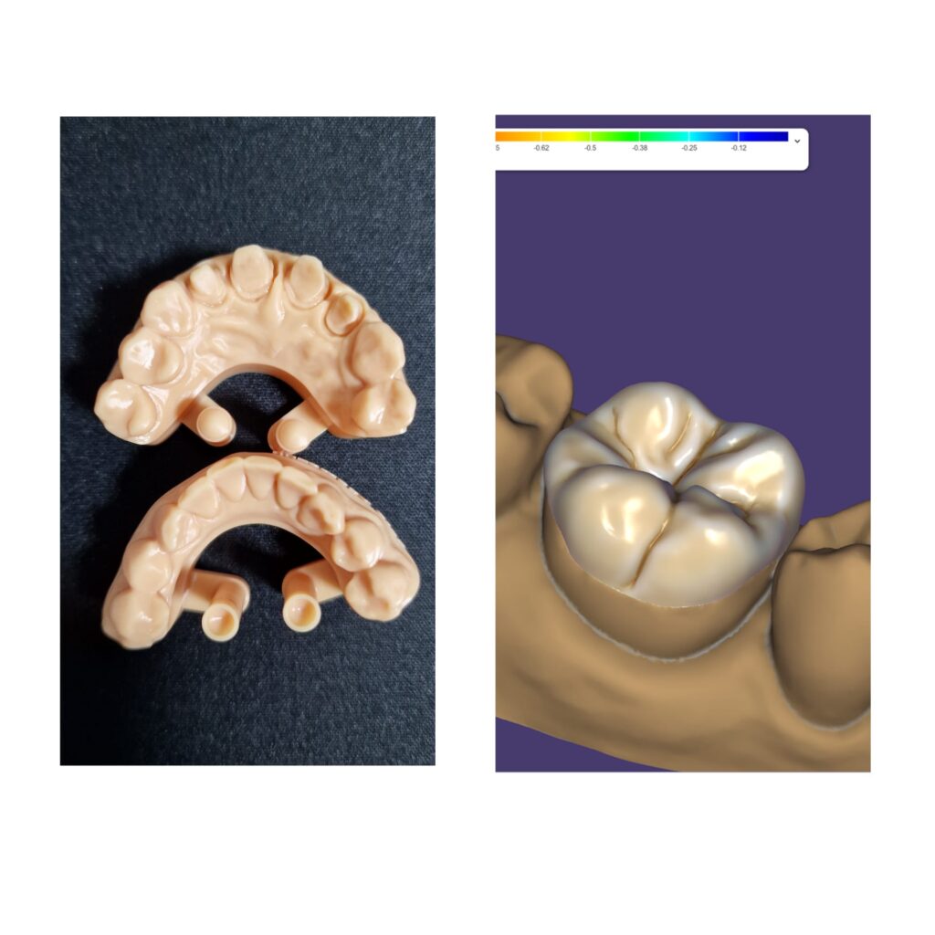 Teeth 2